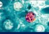Health alert about cyclosporiasis parasitic infection