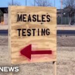 County coroner says Pennsylvania infant died from measles