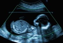Abortions Plummet – Florida’s Hard Line Bites Fetal ultrasound scan image
